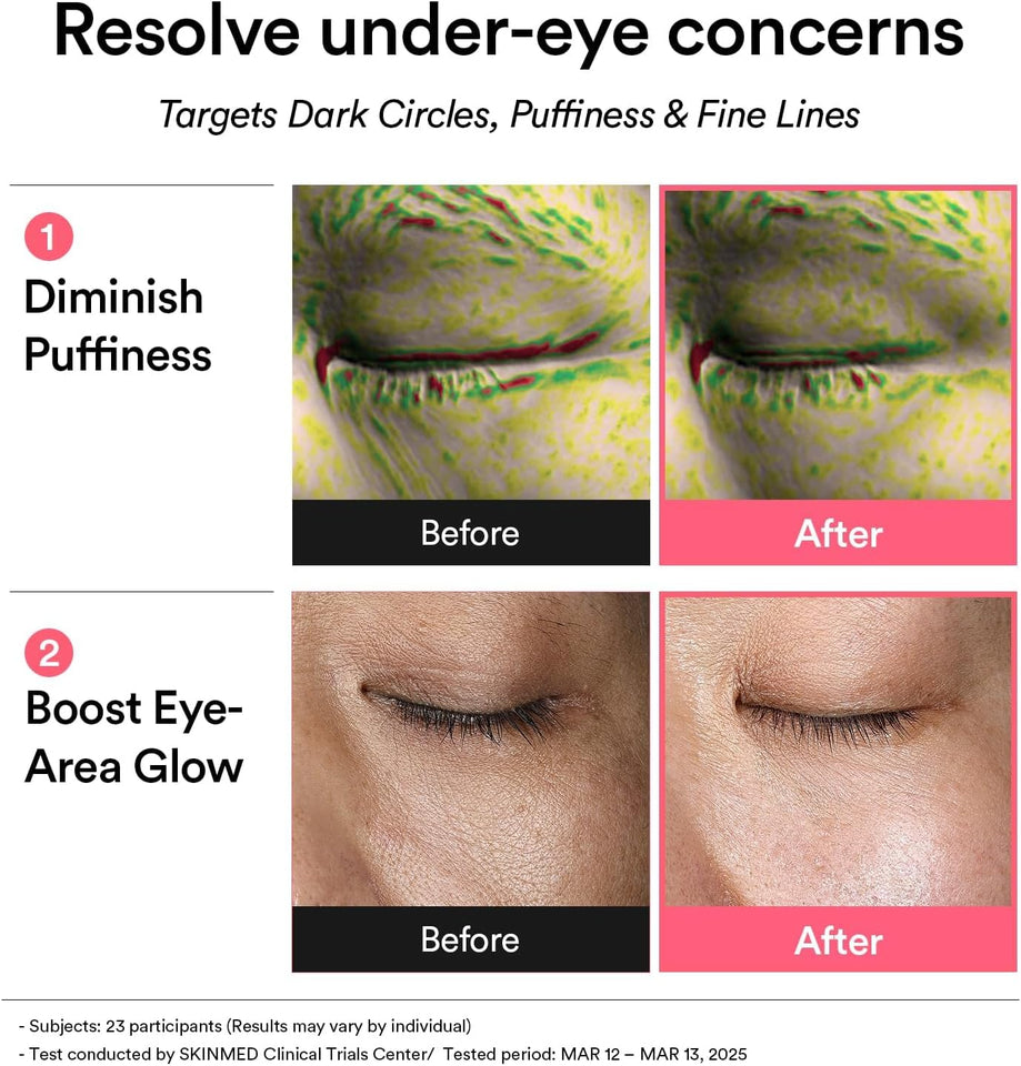 Abib PDRN Retinal Glow Jelly Eye Patches – 60 Patches