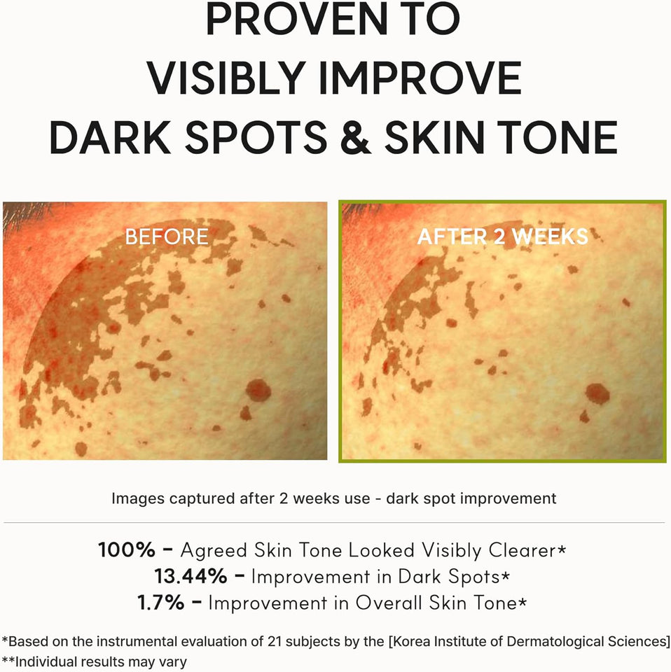 Arencia Vitamin C Booster Shot Serum with Glutathione & Niacinamide, 30ml